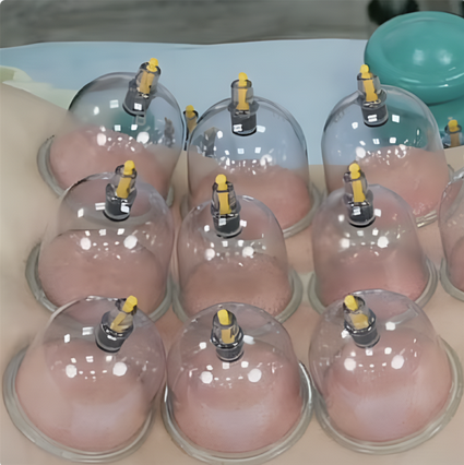 [Александр Сокун] [ККПК] Вакуумно-баночная терапия при болевом синдроме (2024)