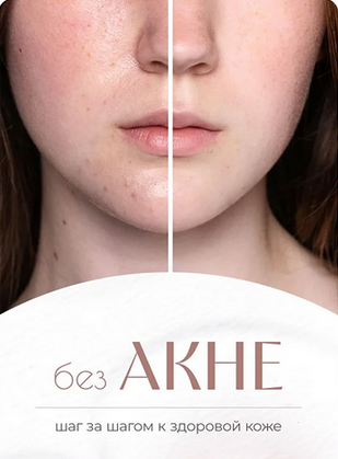 [Ксения Машкина] [dr_mashkina] БезАкне (2023)